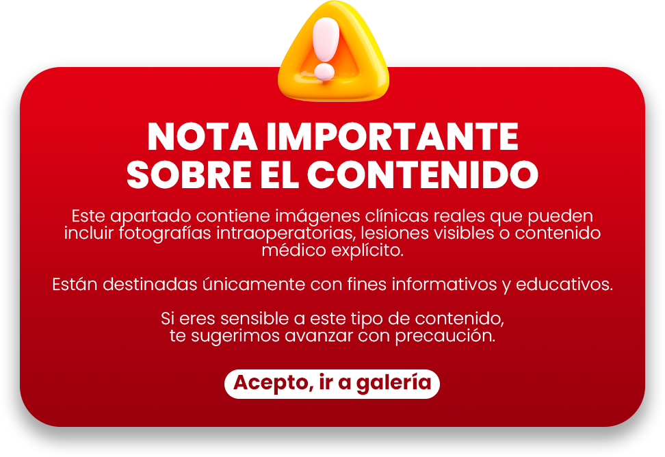 Aviso de precaucion