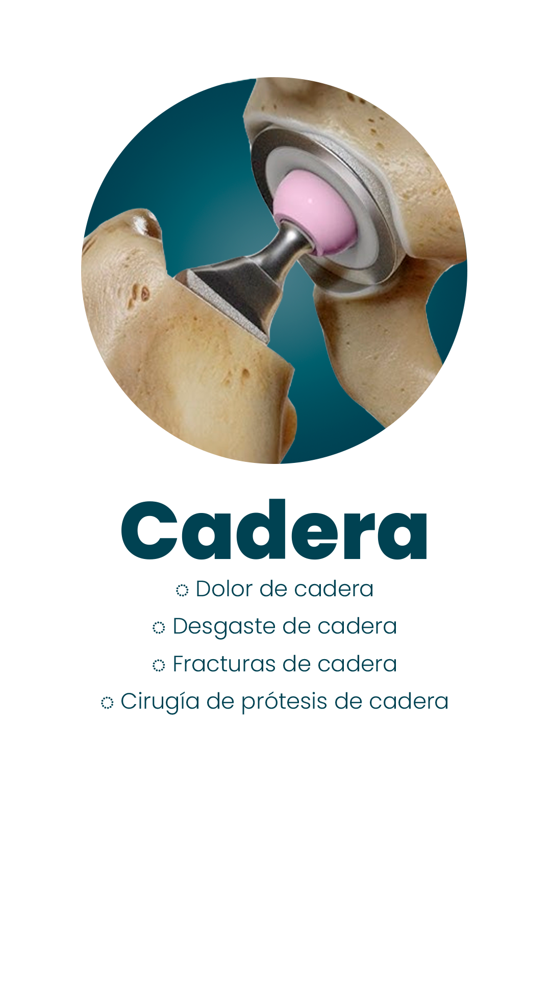 Cadera