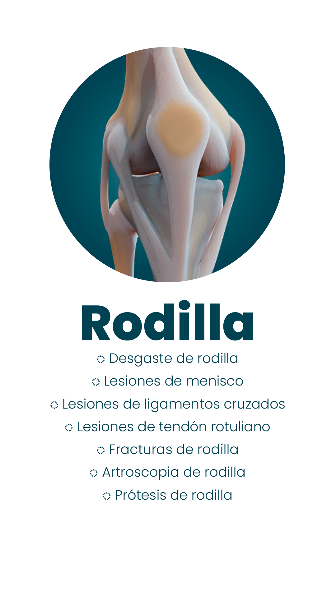 rodilla