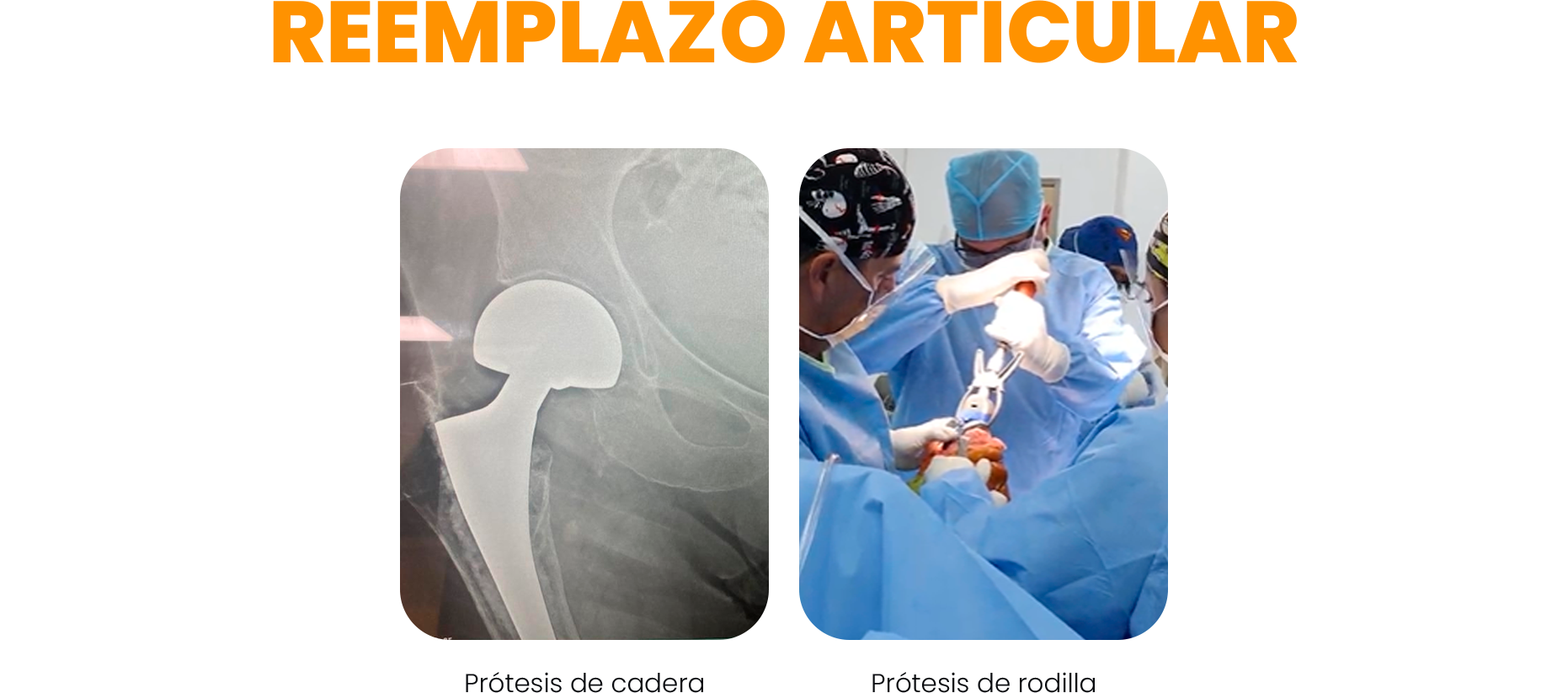 remplazo articular