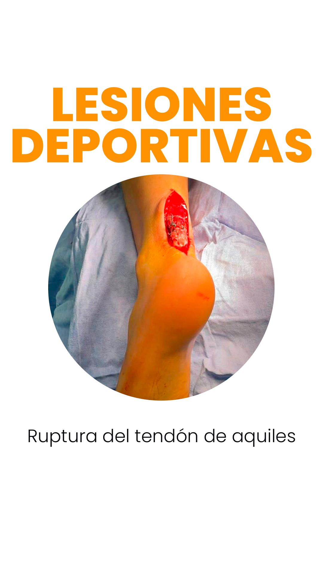 Lesiones deportivas