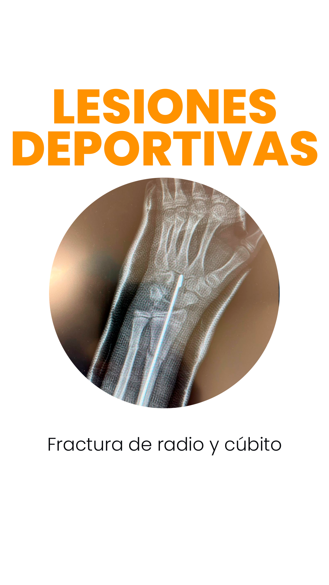 Lesiones deportivas