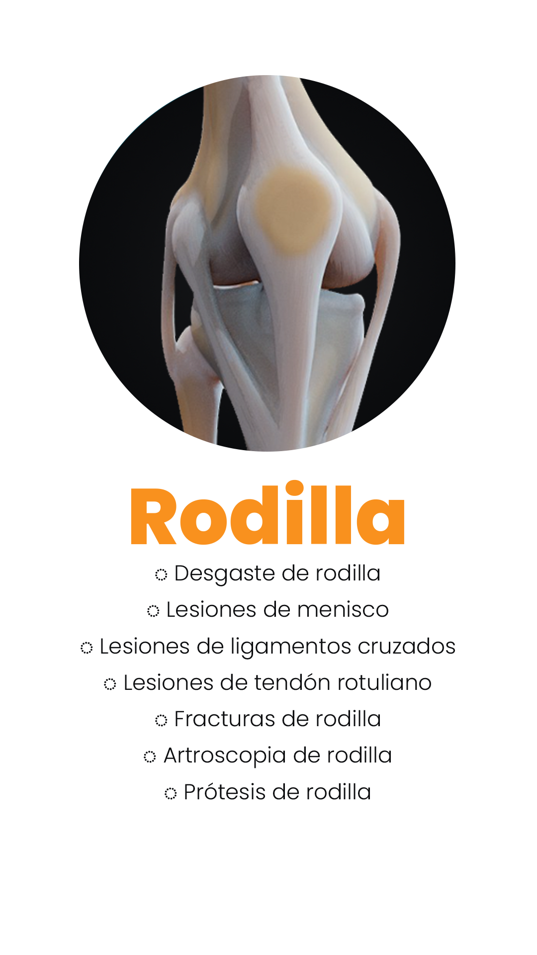 rodilla