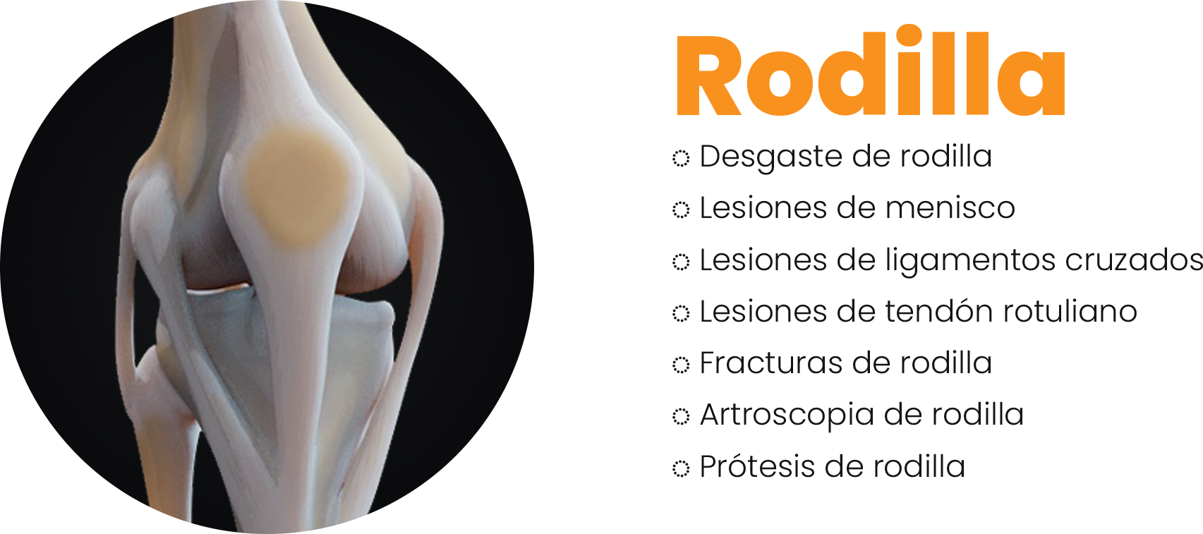 Rodilla
