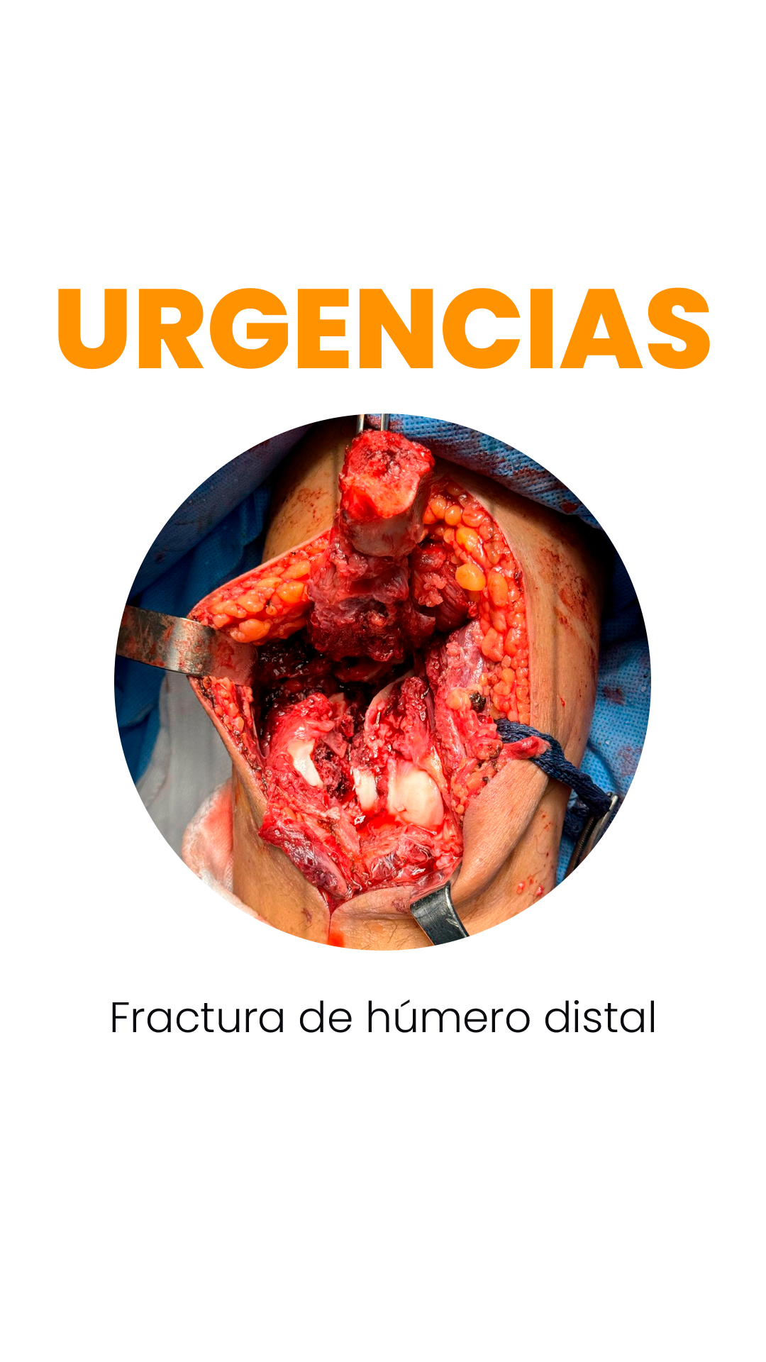 urgencias
